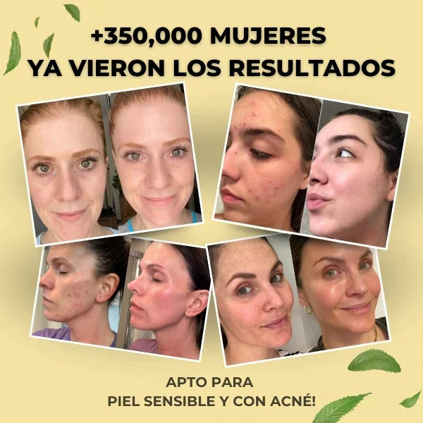 EvilGoods™ Bálsamo Rejuvenecedor – Solución Natural y Efectiva para Piel Seca, Sensible o con Eccema